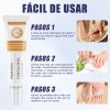 Ungüento Para Hongos En Las Uñas Tratamiento Efectivo 30g