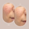 JeNu Pure Hyaluronic Acid Serum, 1 fl. oz.