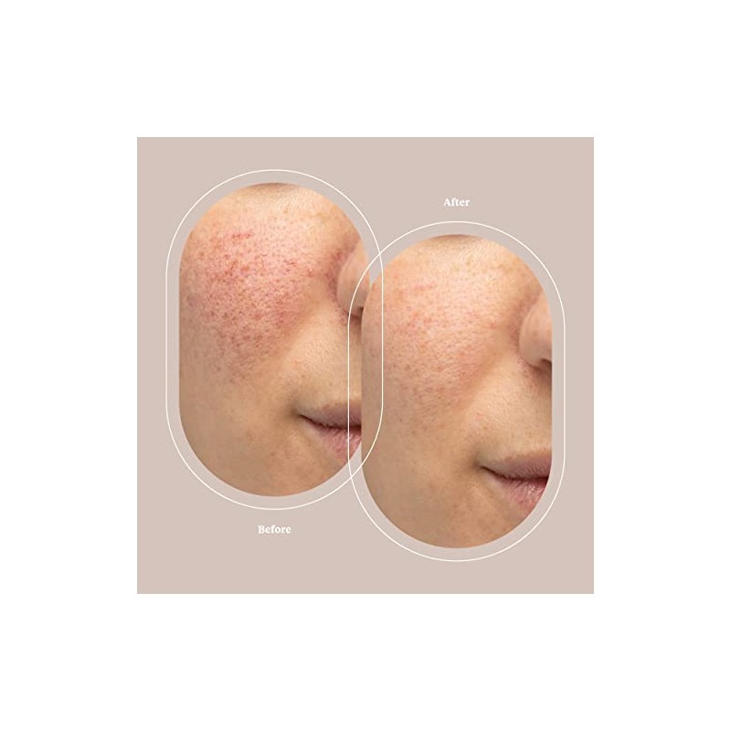 JeNu Pure Hyaluronic Acid Serum, 1 fl. oz.