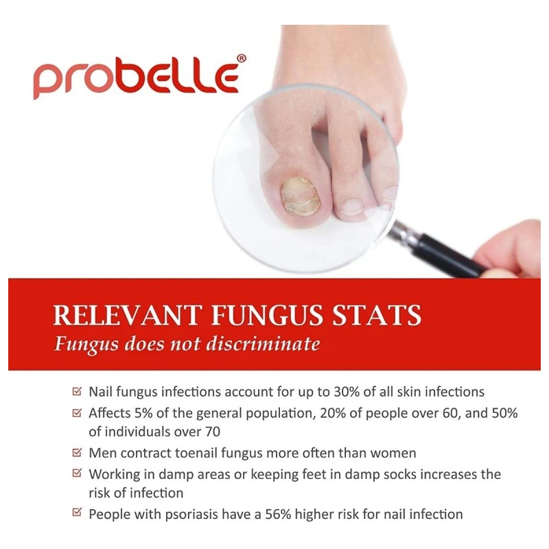 Probelle Tratamiento Natural Para Hogos En Las Uñas.