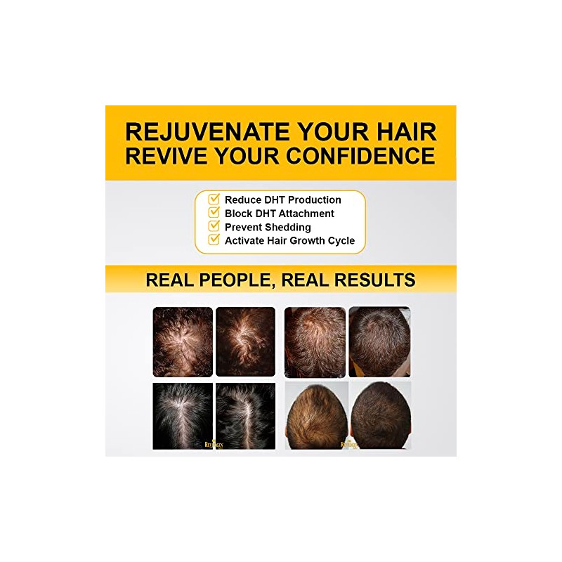 Revivogen MD Scalp Therapy Thinning Hair Solution, Shampoo & Conditioner