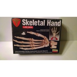 Lindberg Skeletal Hand