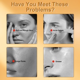 2 Stück Kurkuma Seife, Vegane Duschseife Kojic Acid Soap für Gesicht und Körper, Kojisäure Seifenstück für Entfernen Dunkler Flecken Gleicht den Hautton Saubere Haut Schmutz