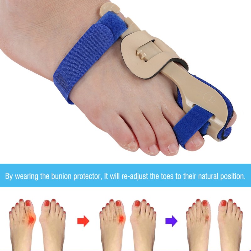 1Pair Woman Female Toe Separators Hallux Valgus Bunion Corrector Right