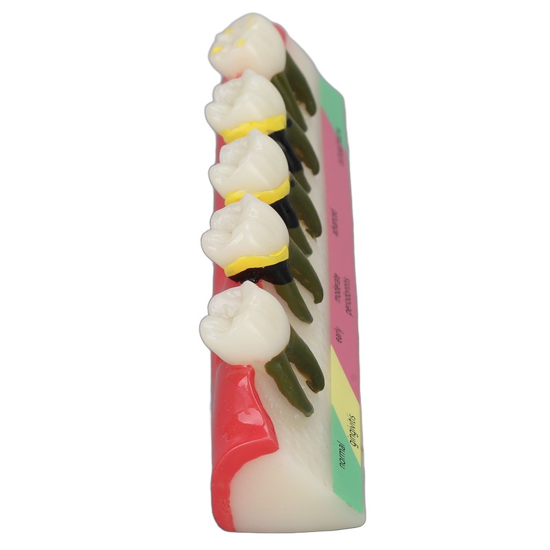 Dental Teeth Model Ceramic Clear Structure Oral Care Educational Periodontal