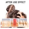 R Aceite Para El Crecimiento Del Cabello, 2 Unidades, 60