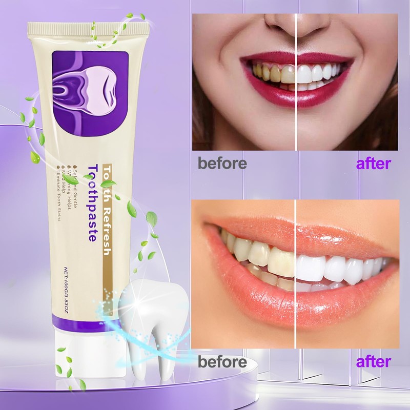 VLUVLA 3 Pcs Nature Tooth Refresh Toothpaste, Tooth Refresh Toothpaste