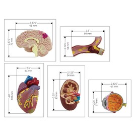 GPI Anatomicals - Hypertension Model Set, Replica for Human Anatomy and Physiology Education, Anatomy Model for Doctor's Offices and Classrooms, Medical Learning Resources
