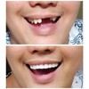 Instant Smile Comfort Fit Flexible Lower Teeth