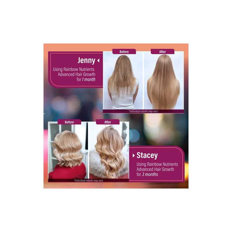 Vitaminas Para El Crecimiento Del Cabello, Rainbow Nutrients