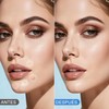 NEARPOW 360 Parches para Acné, Pimple Patch Invisible Granos y