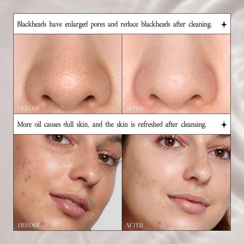Deep Cleansing Mud Mask Stick - 45g Large Capacity with
