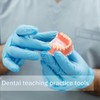 Dental Model Overdenture Transparent Dental Implants Model Detachable Model Lower