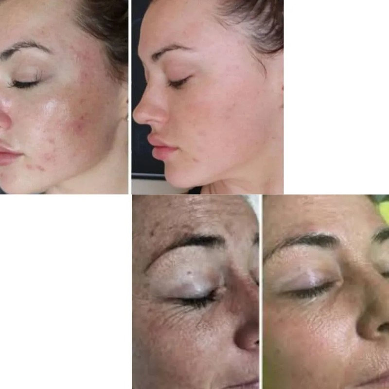 Sheló Nabel Crema Jabón Facial Baba de Caracol Pack 2