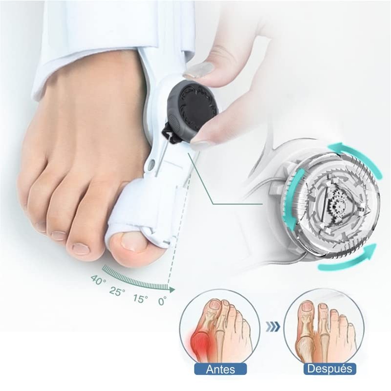 Bellati - 1 pieza PREMIUM Corrector de juanetes para mujeres