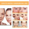 Ácido Glicólico Solución Tonificante Exfoliante Antimanchas