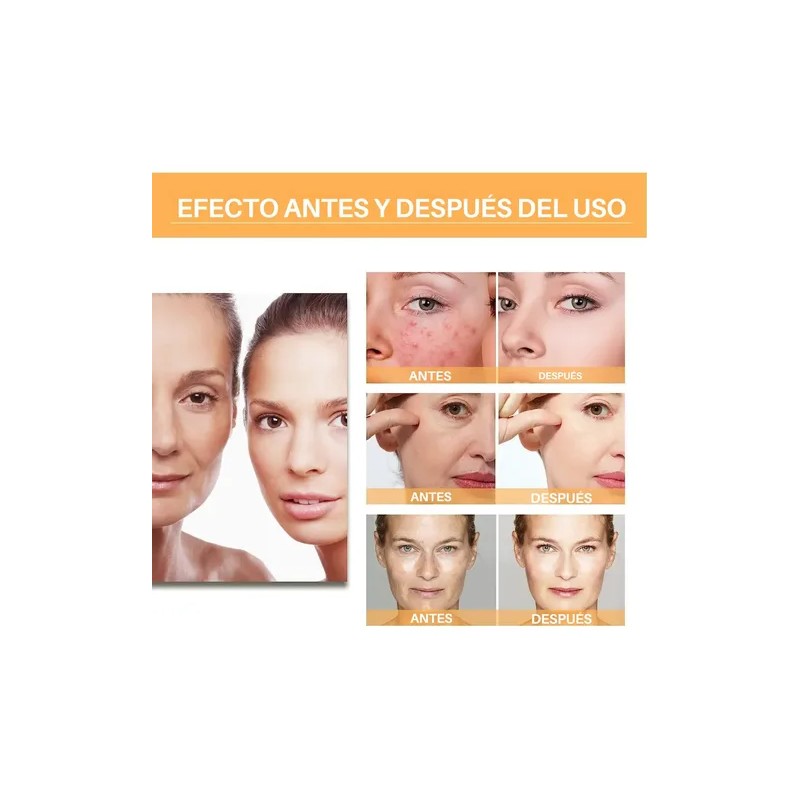 Ácido Glicólico Solución Tonificante Exfoliante Antimanchas
