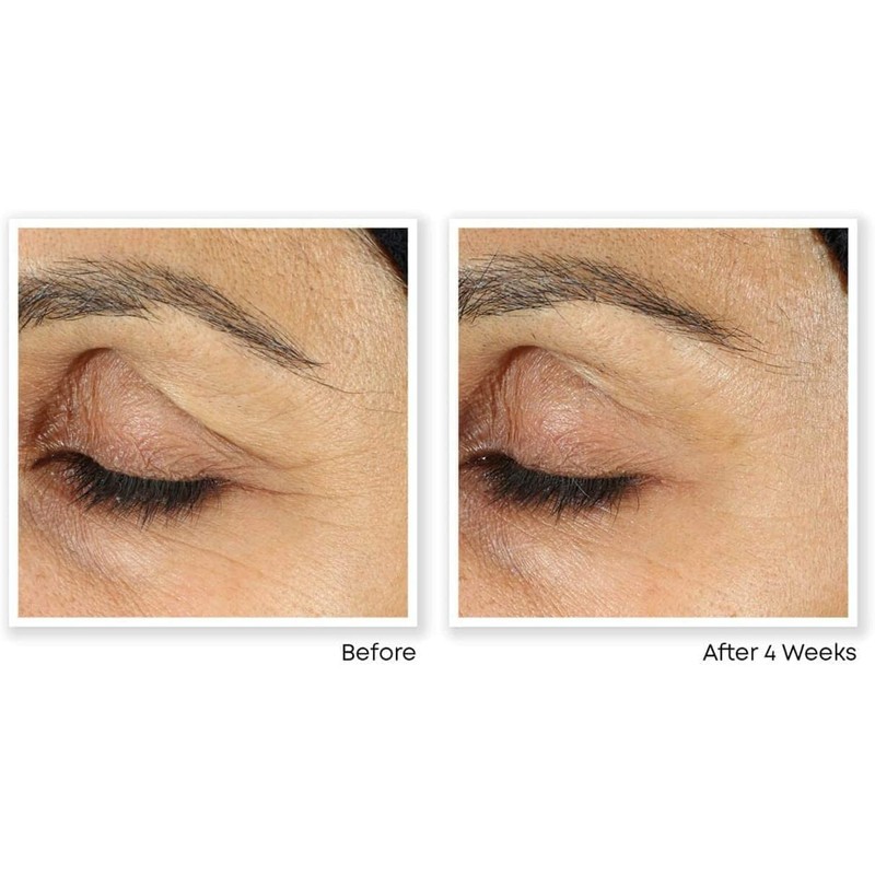 RoC - Retinol Correxion Line Smoothing Eye Cream - Visibly