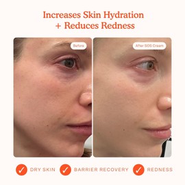 Tower 28 SOS Recovery Face Cream - Moisturizing Facial Moisturizer with Hyaluronic Acid + Ceramides Repairs skin barrier Moisturizer reduces redness and improves texture Sensitive Skin Care (1.86 oz) / 타워 28 SOS 리커버리 페이스 크림 - 히알루론산 + 세라마이드로 보습 얼굴 보습제 피부 장벽 복구 보습제가 발적을 줄이고 텍스처를 개선합니다 민감성 스킨 케어 (1.86온스)