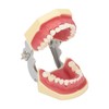 Periodontal Disease Teeth Resin Model Dental Demonstration Teeth Model for