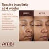 Ambi Even & Clear Fade Cream, Hydroquinone-free, Hyperpigmentation Treatment, Dark