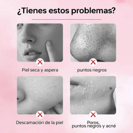 Gel Exfoliante Blanqueador Quarxery Para Eliminar Puntos Neg