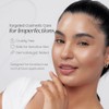 Dotless Gel Tratamiento Focalizado para Imperfecciones y Acné 30 ml