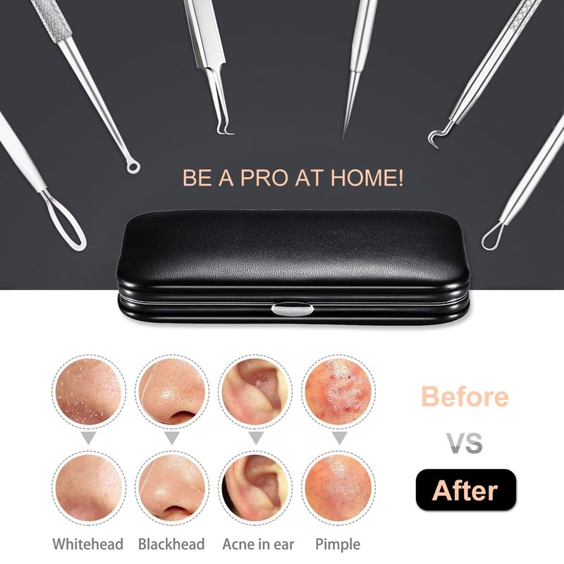 Antonki Antonki 6 Pack Blackhead Remover Tools, Blackhead Extractor, Pimple
