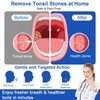Tonsil Stone Vacuum Remover with LED Light Upgraded Electronic Oral