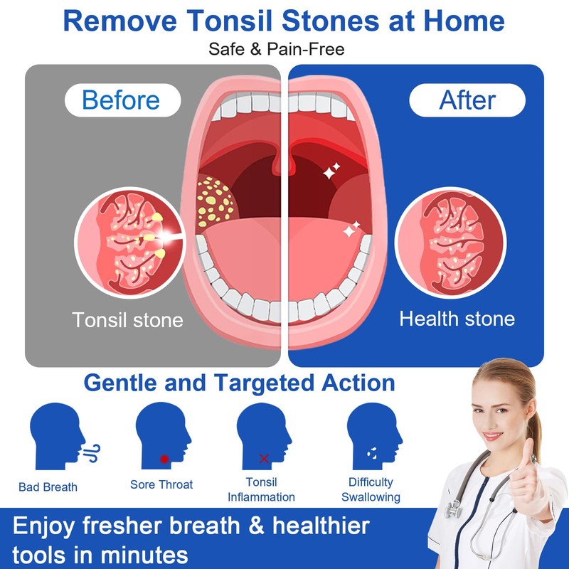 Tonsil Stone Vacuum Remover with LED Light Upgraded Electronic Oral