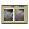 Crema Despigmentante Natural 60g Niacinamida 10% Anti Mancha