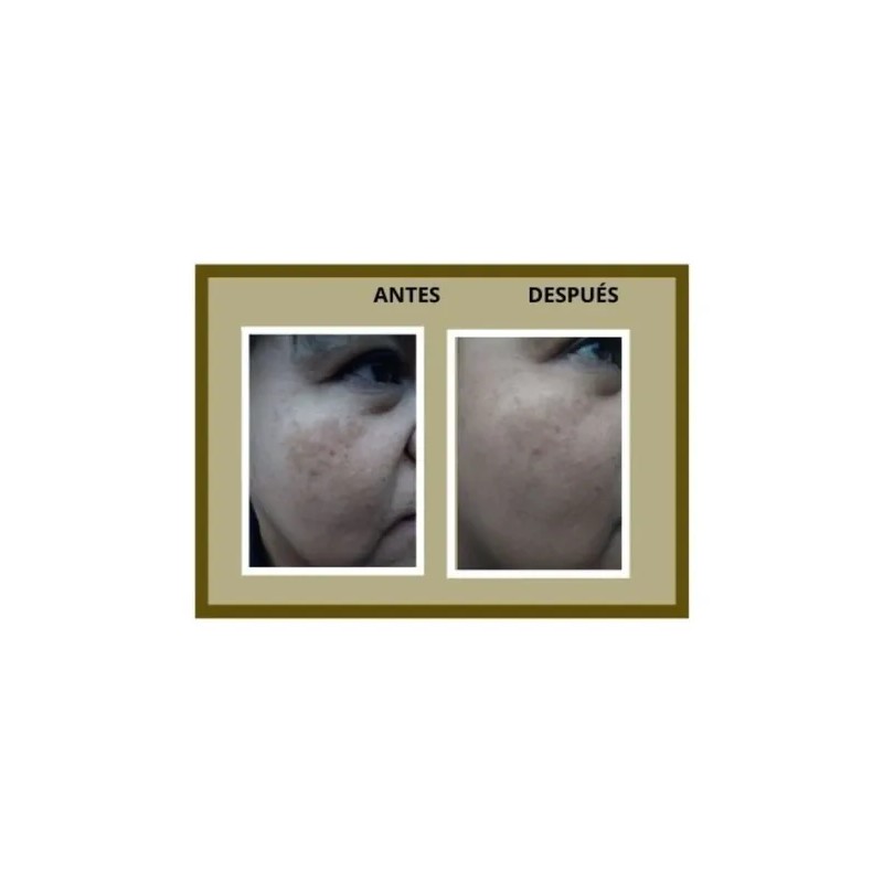Crema Despigmentante Natural 60g Niacinamida 10% Anti Mancha