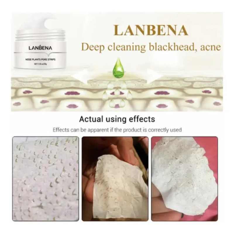 Lanbena Crema Para Puntos Negros + 60 Papeles