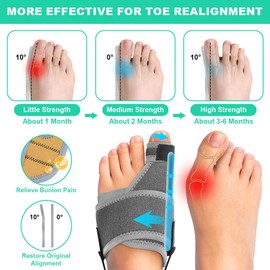 Vicloon Adjustable Bunion Splint, 2Pcs Bunion Corrector for Women and Men, Big Toe Straightener for Bunion with 2 Angle Fixation Plates and Double Non-slip Strap, Day & Night Support, Grey