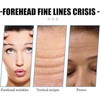 Forehead Plaster