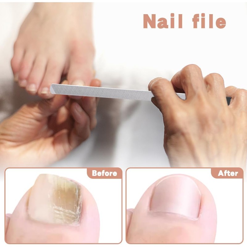 Xiaokeis 2 Limas De Uñas Gruesas Para Pies, Lima Profesional