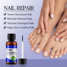 Apooliy 30ML Zehennagelpilz Behandlung Extra Strength, Powerful Nail Care Renewal & Recovery Liquid für dicke, beschädigte & verfärbte Nägel Remedy