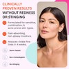 Fig.1 Crema para ojos Pro-Retinol para mujeres, 0,5 fl oz