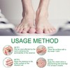Ginger Nail, Tratamiento de Uñas con Jengibre, Soporte para Uñas,