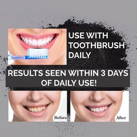 Lumeeno All Natural Organic Activated Charcoal Teeth Whitening For Sensitive Tooth and Gum - Whiten, Clean and Detoxify - Vegan - No Chemicals - Zero Bleach Whitener Enough for 150+ Uses