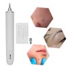 Mole Removal Pen USB 3 Gears Adjustment Freckle Spots Removal