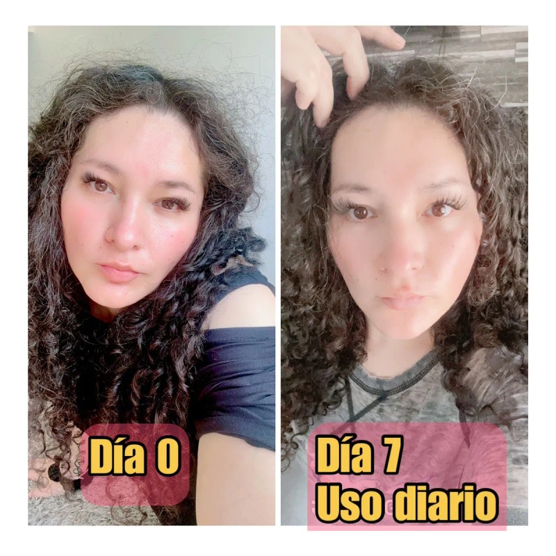 Serum Antiaging C/estriol 10x Potencia Rejuvenece En 7 Dias!