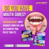 Gel Para El Dolor De Muelas, Gel Oral Con 20