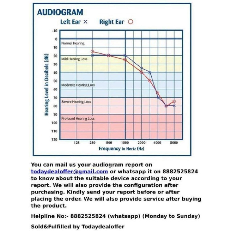 Signia/Connexx Sleeve Click CIC ITC & RIC Hearing Aid Domes