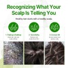 SOME BY MI Cica Peptide Anti Hair Loss Scalp Shampoo,