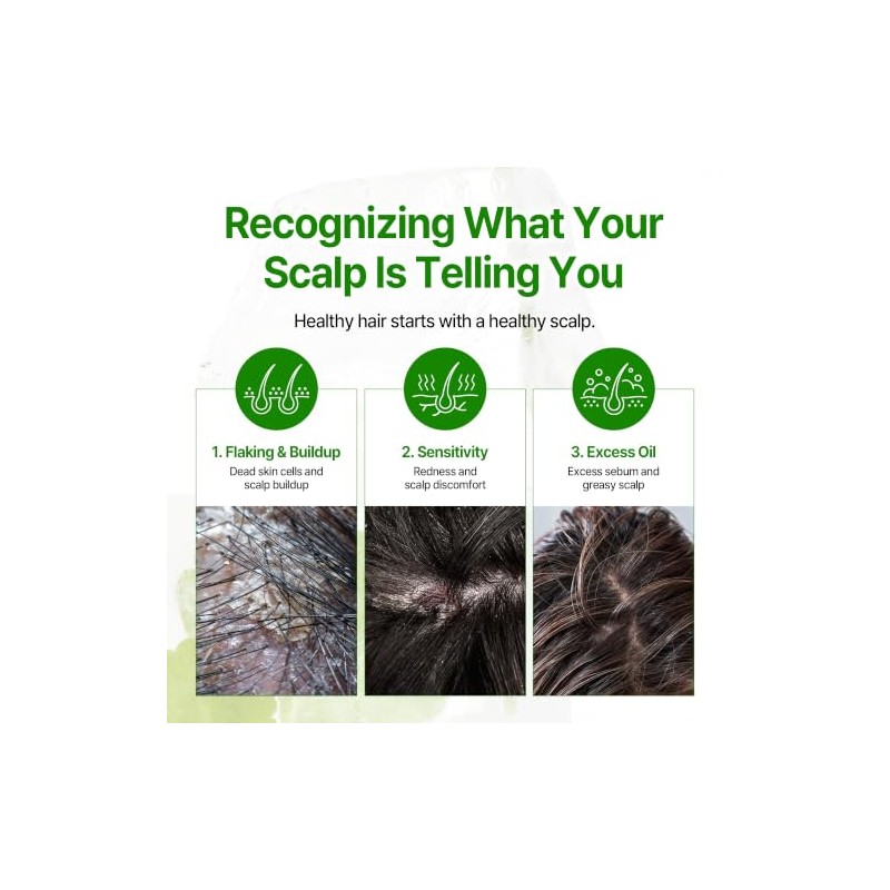 SOME BY MI Cica Peptide Anti Hair Loss Scalp Shampoo,