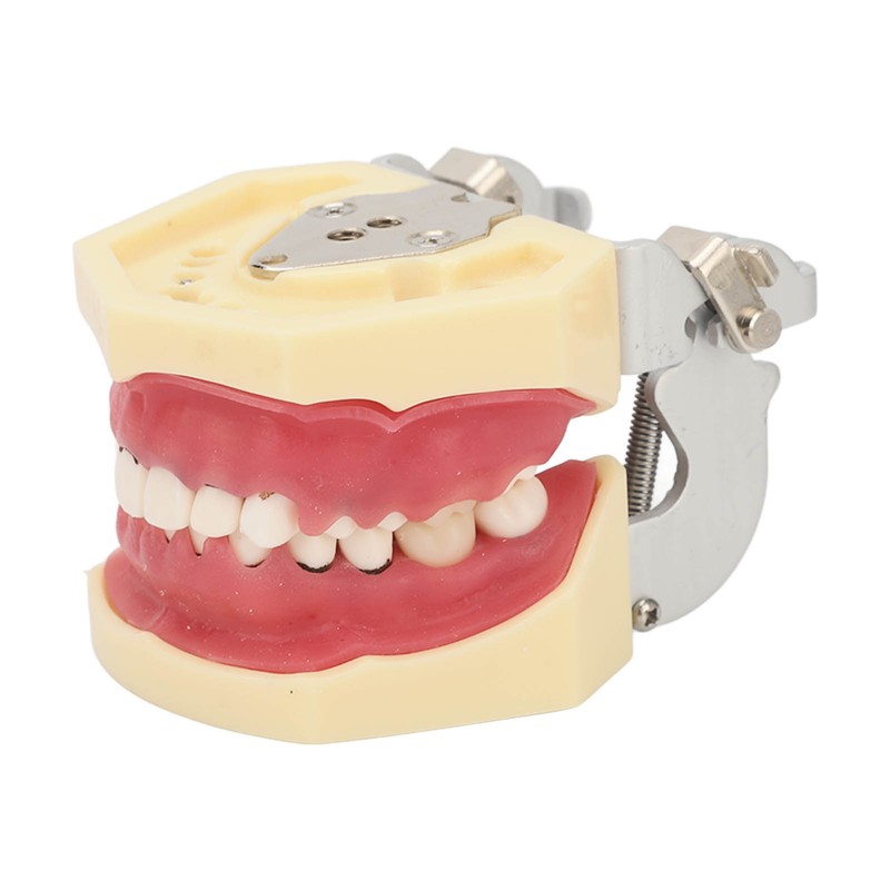 Periodontal Disease Teeth Resin Model Dental Demonstration Teeth Model for