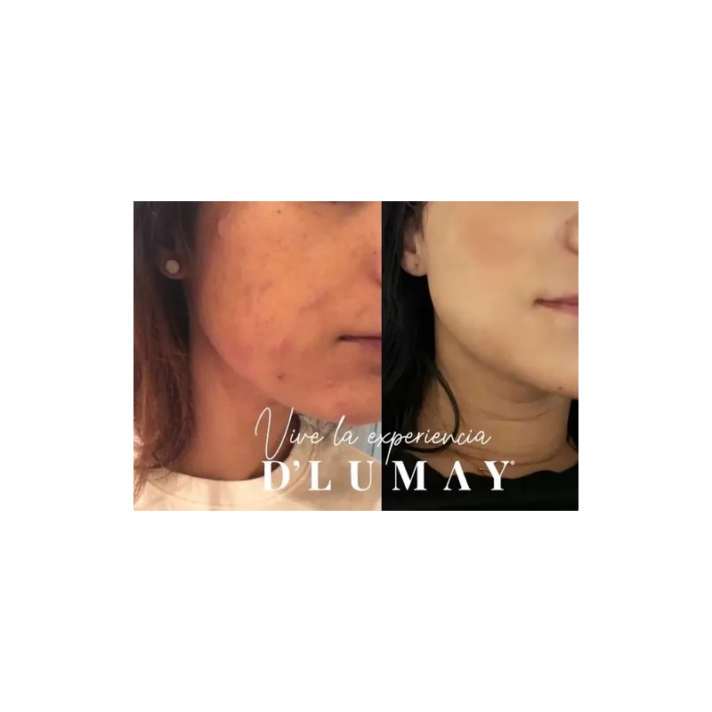 Dlumay Nueva Crema Rescue 60gr