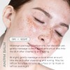 COSMEDIX Rescue Intense Hydrating Balm and Mask, 1.7 Ounce