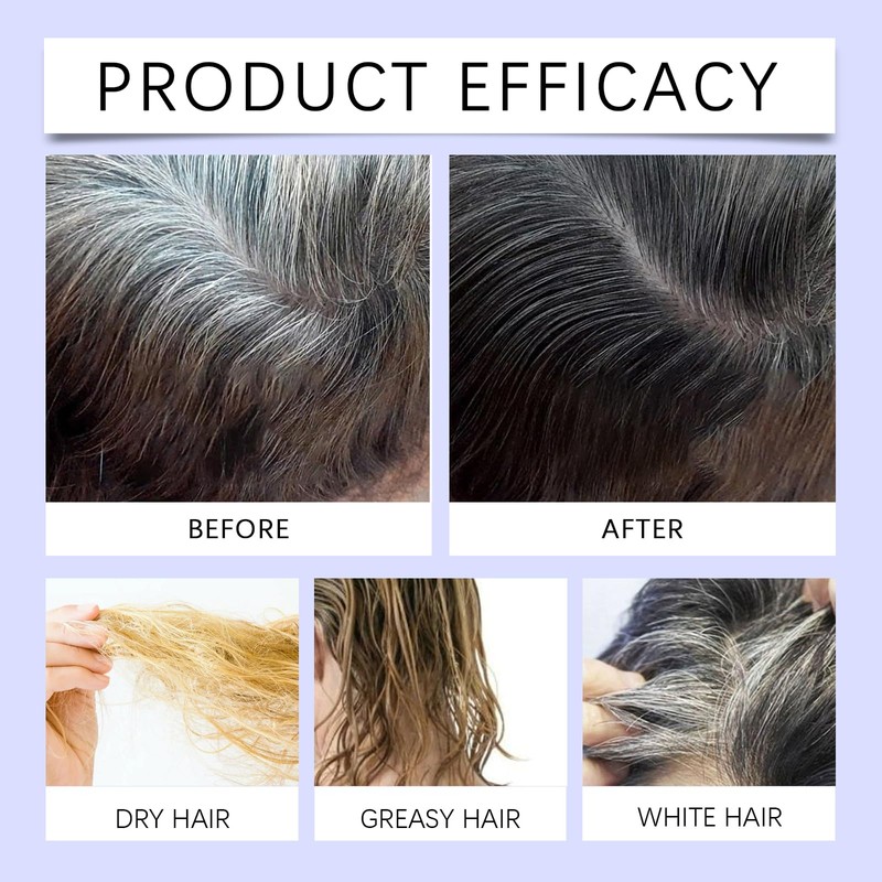 Anti-Grey Hair Serum